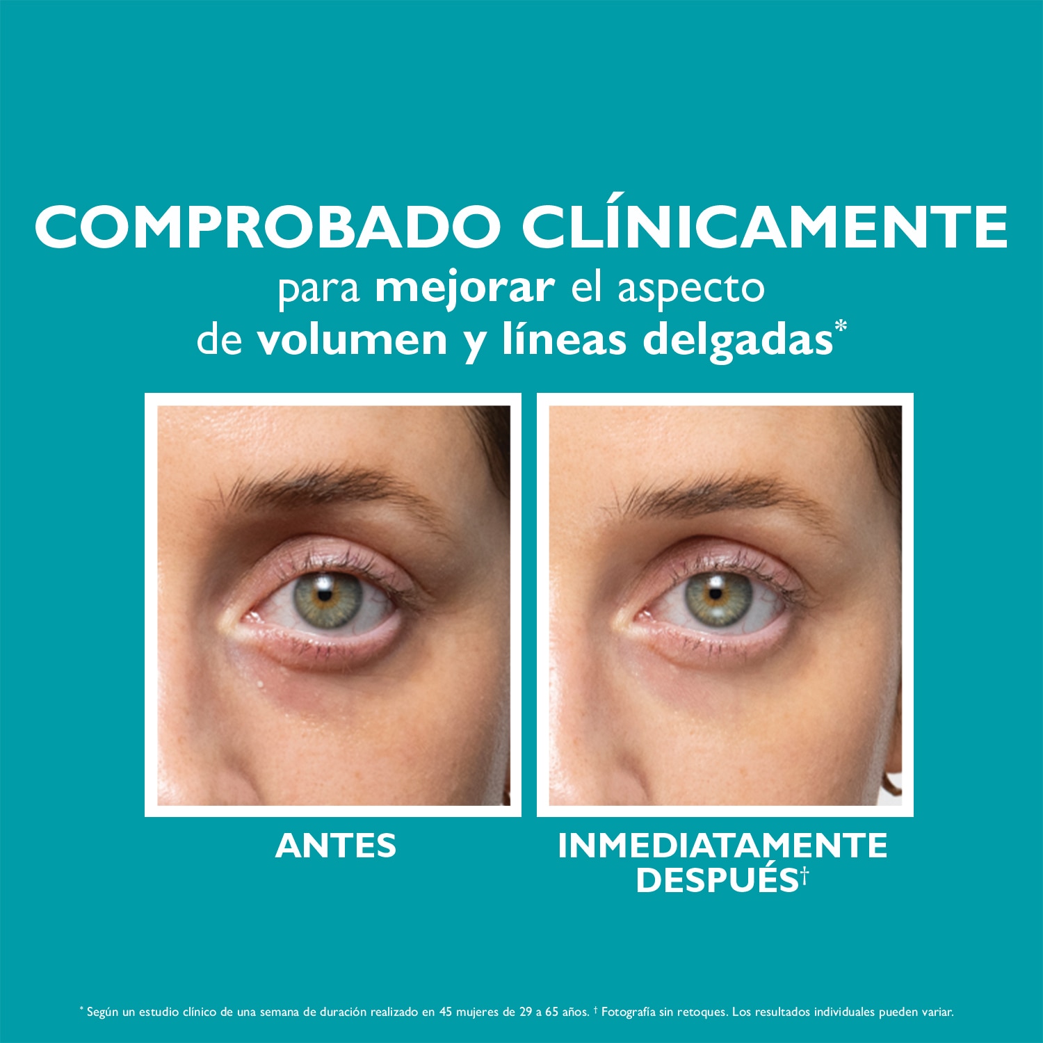 PEPTIDE SKINJECTION UNDER EYE CREAM (CREMA PARA CONTORNO DE OJOS)